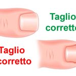 come tagliarsi correttamente le unghia dei piedi